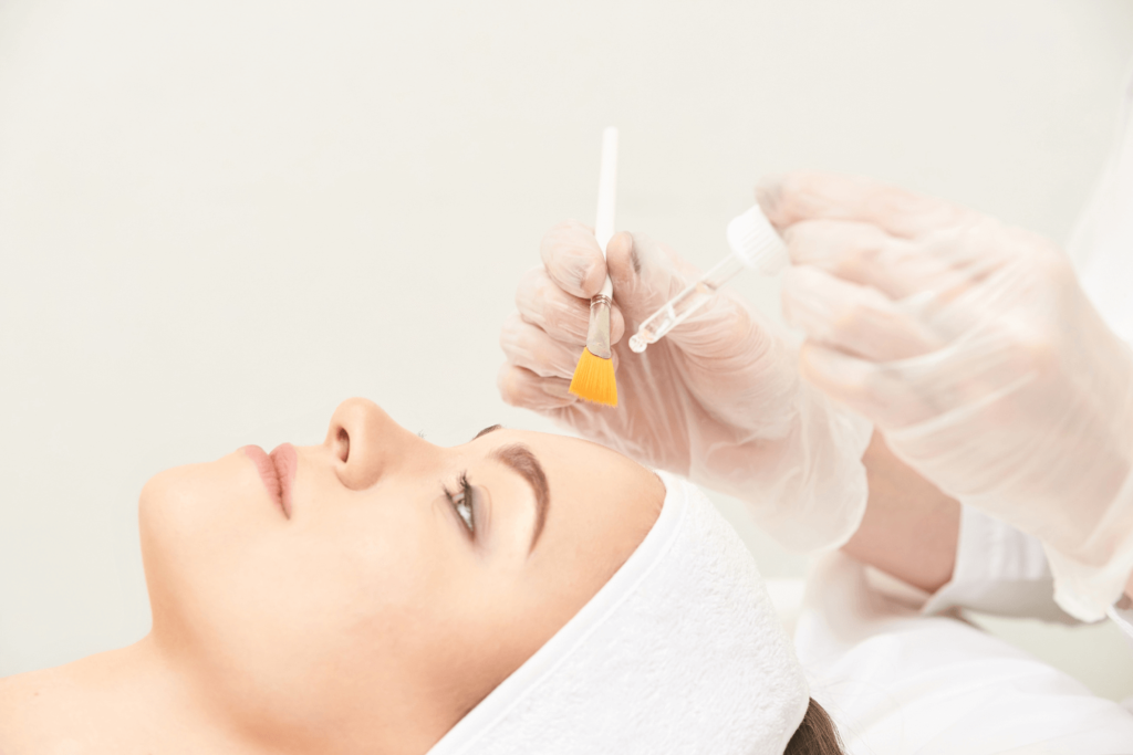Chemical peels for acne scars treatment at BossBeautyBar