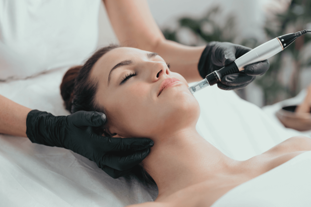 PRP PRF treatment for acne scars at BossBeautyBar