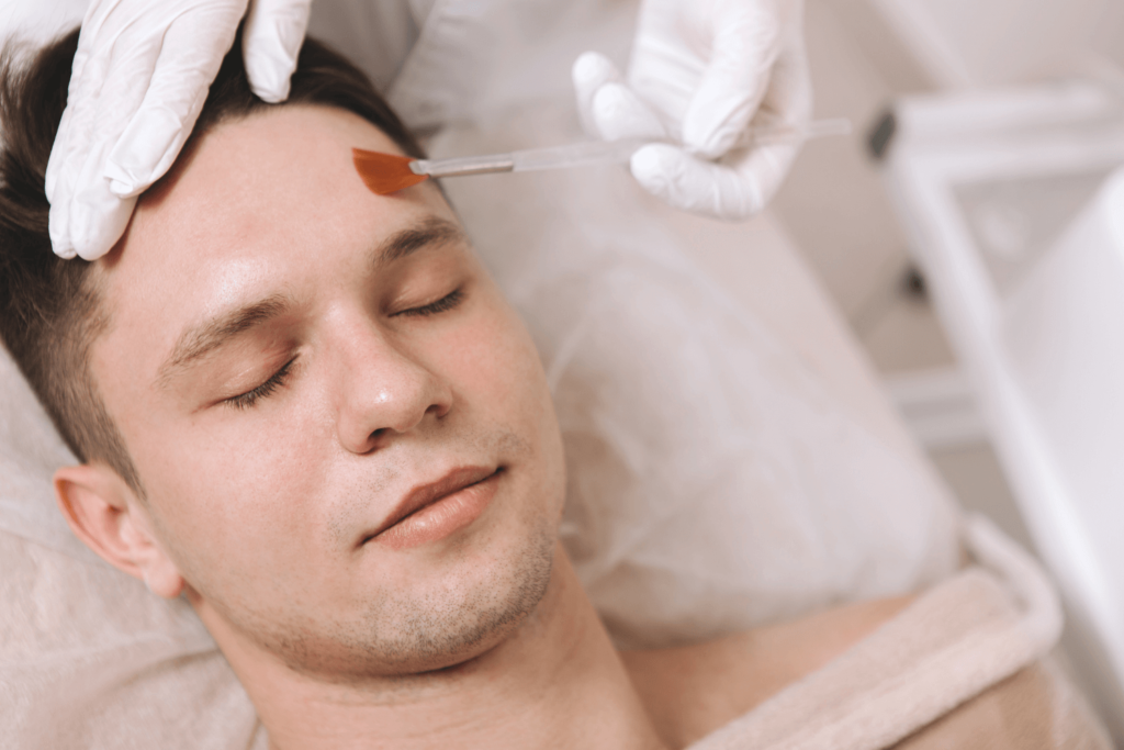 Man receiving PRP Microneedling RF treatment at BossBeautyBar.
