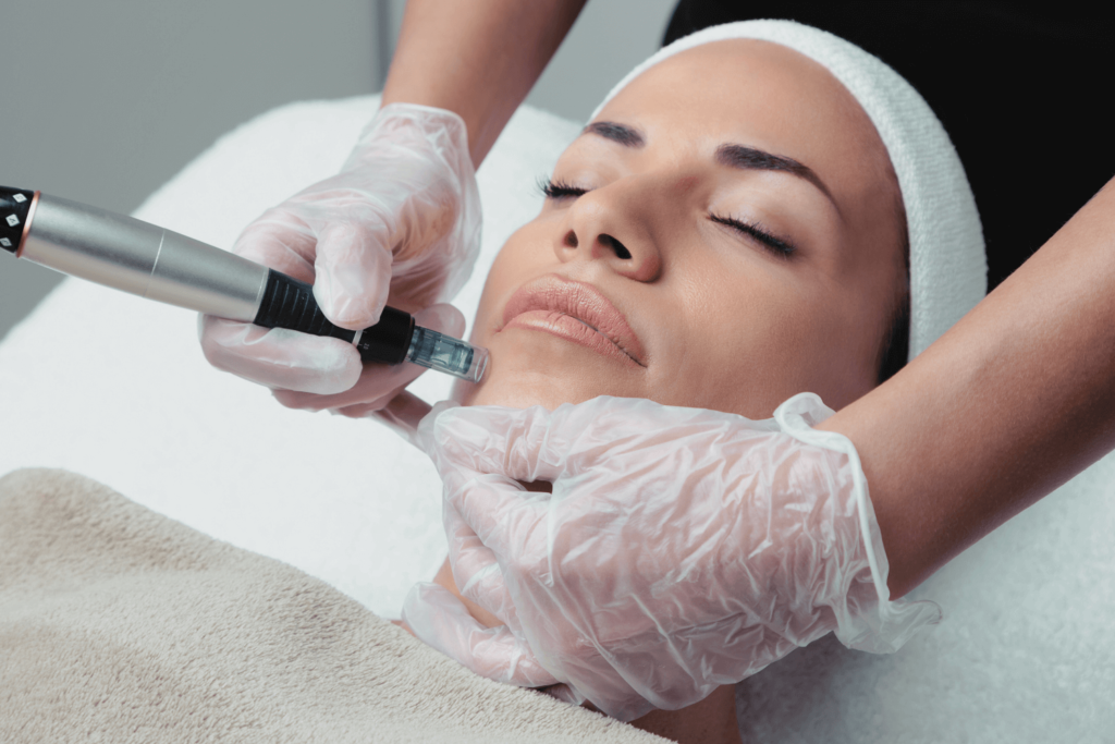 Woman receiving Microneedling with Skin Boosters treatment at BossBeautyBar.